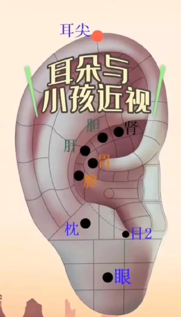 贴耳豆减肥的位置图片图片