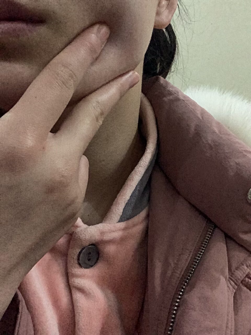 下颌骨长了个圆圆的肿块 朋友们,我这个区域长了个