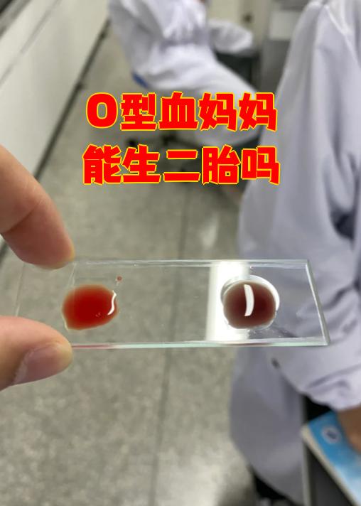 o型血妈妈本身的血型不会对生育二胎造成绝对的阻碍