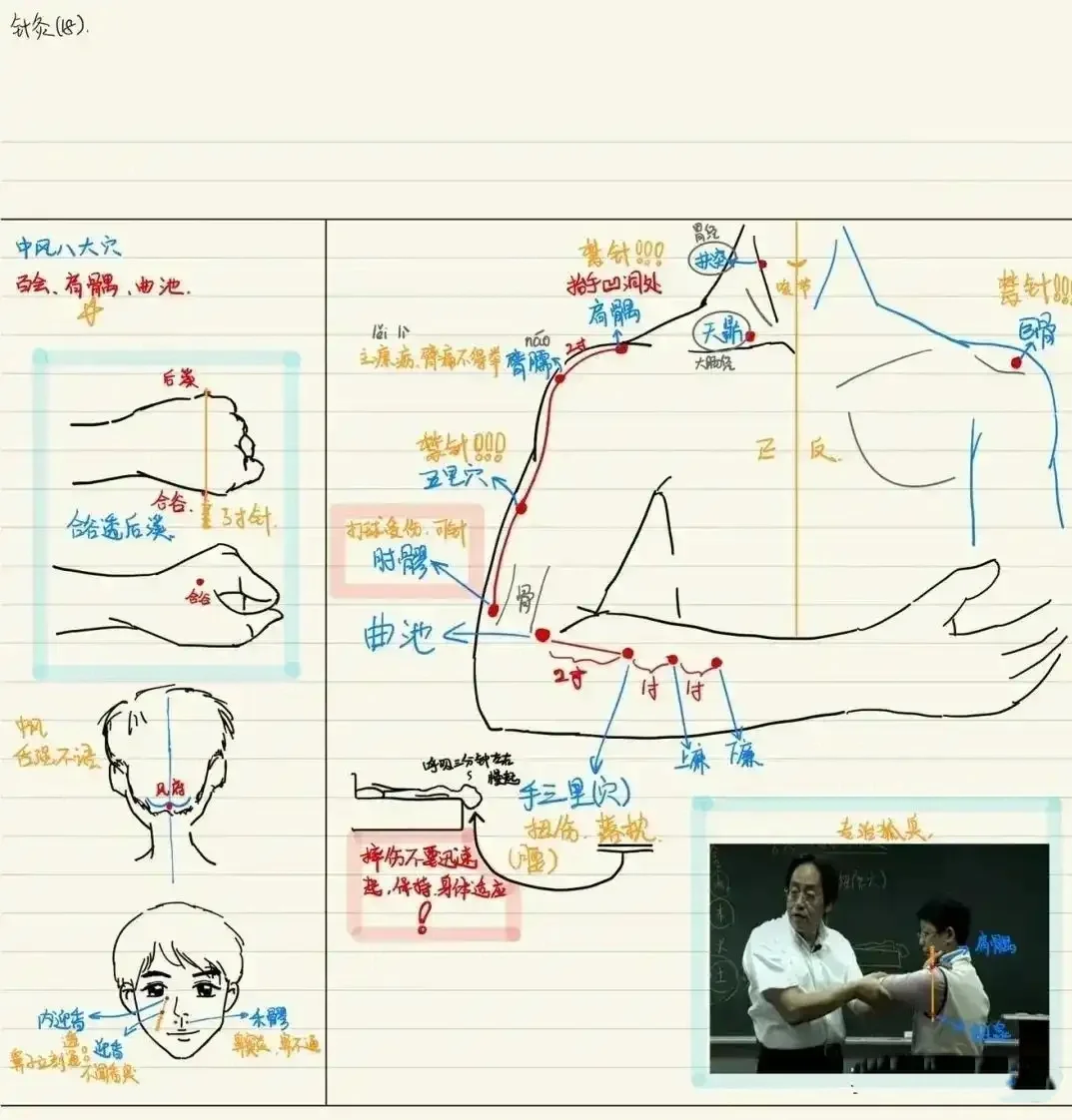 偏瘫针灸位置图片