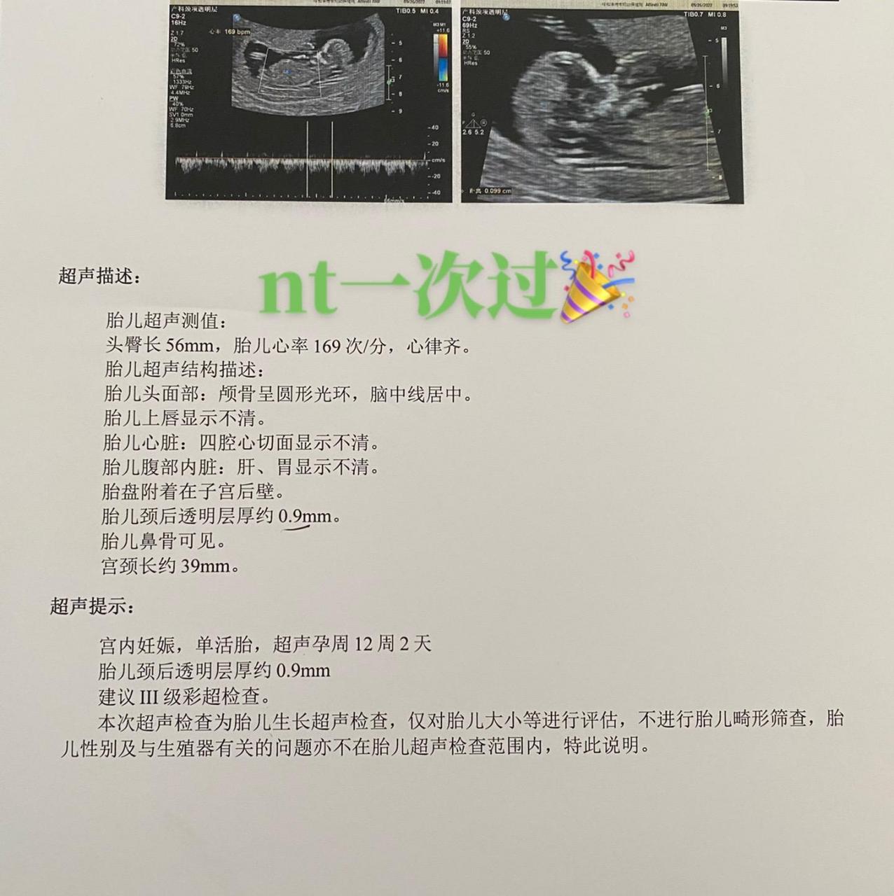 nt值对照表图片