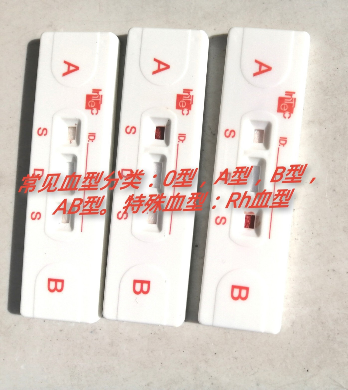 ab型血为什么叫"贵族血"?