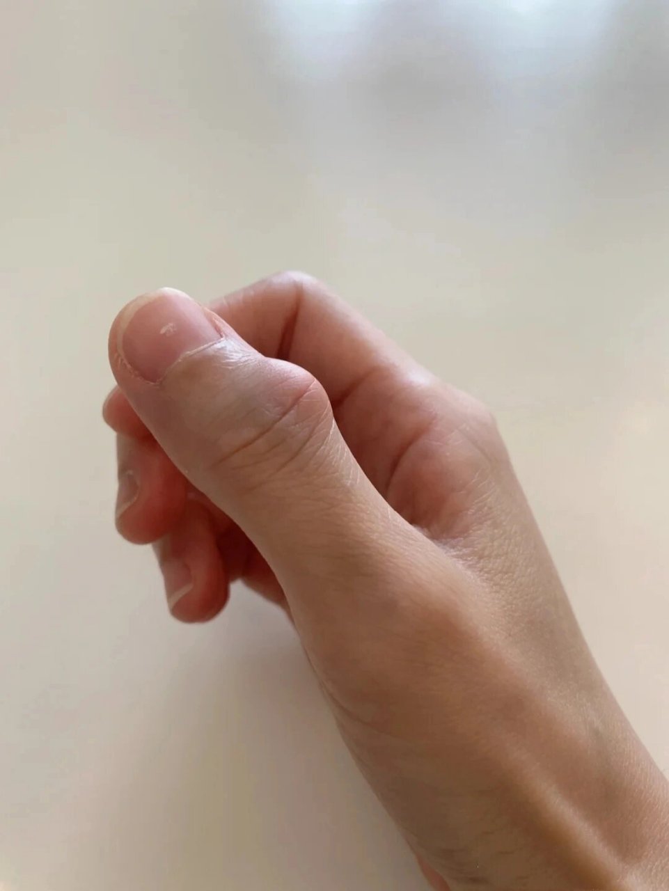 大拇指关节处长个包,是什么情况,平时不怎么痛,就是关注它时总碰又会