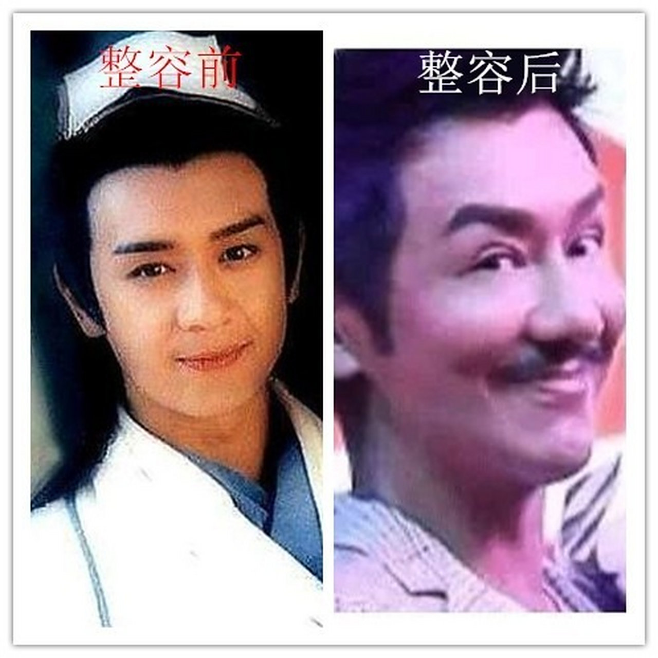 整容最失败的六个男明星,令人惋惜!