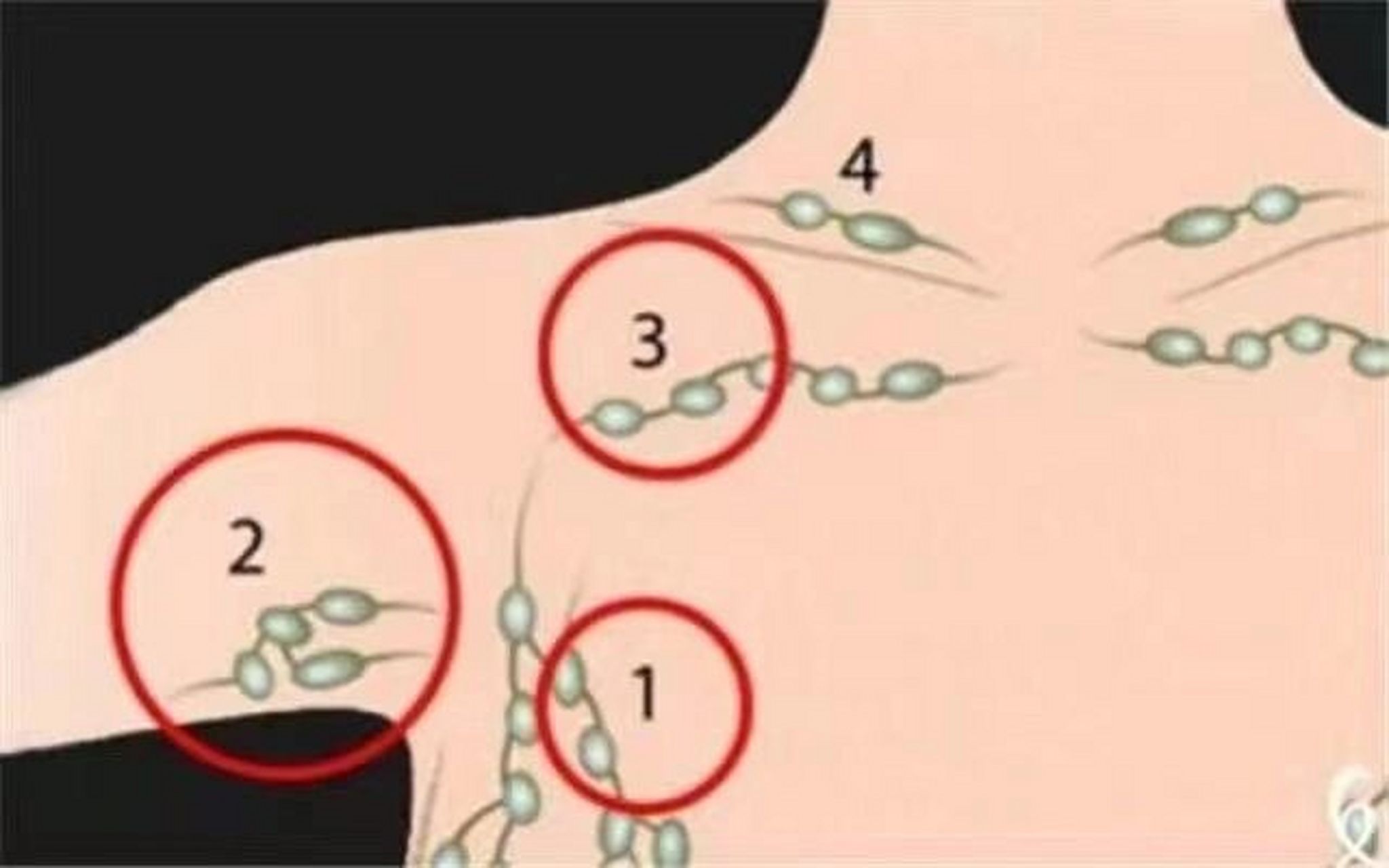 女性经常疏通腋下淋巴的好处: 1,改善胸部不适,防胸部疾病.