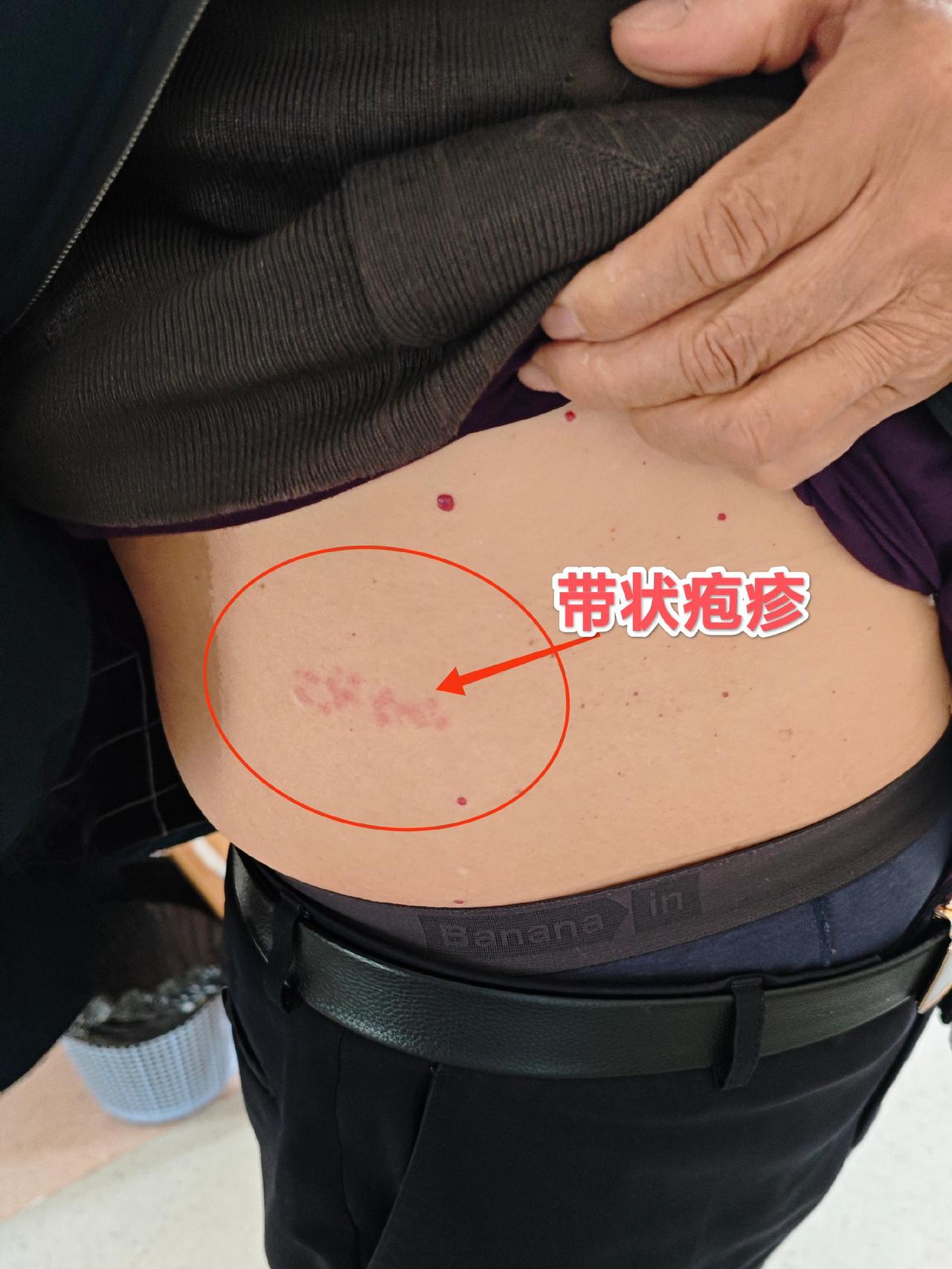 患者出现持续性的胸痛,或者是腹痛,背痛