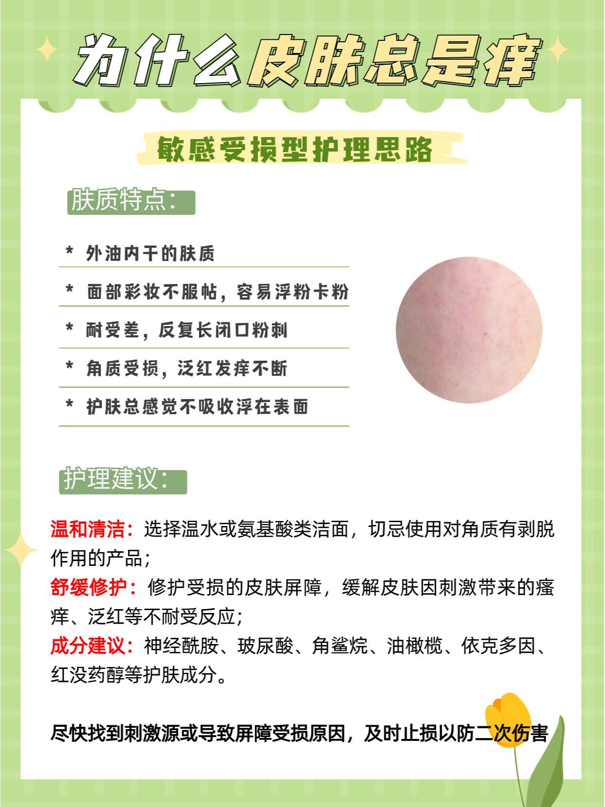 脸颊瘙痒是怎么回事 大家是不是遇到过这些情况?