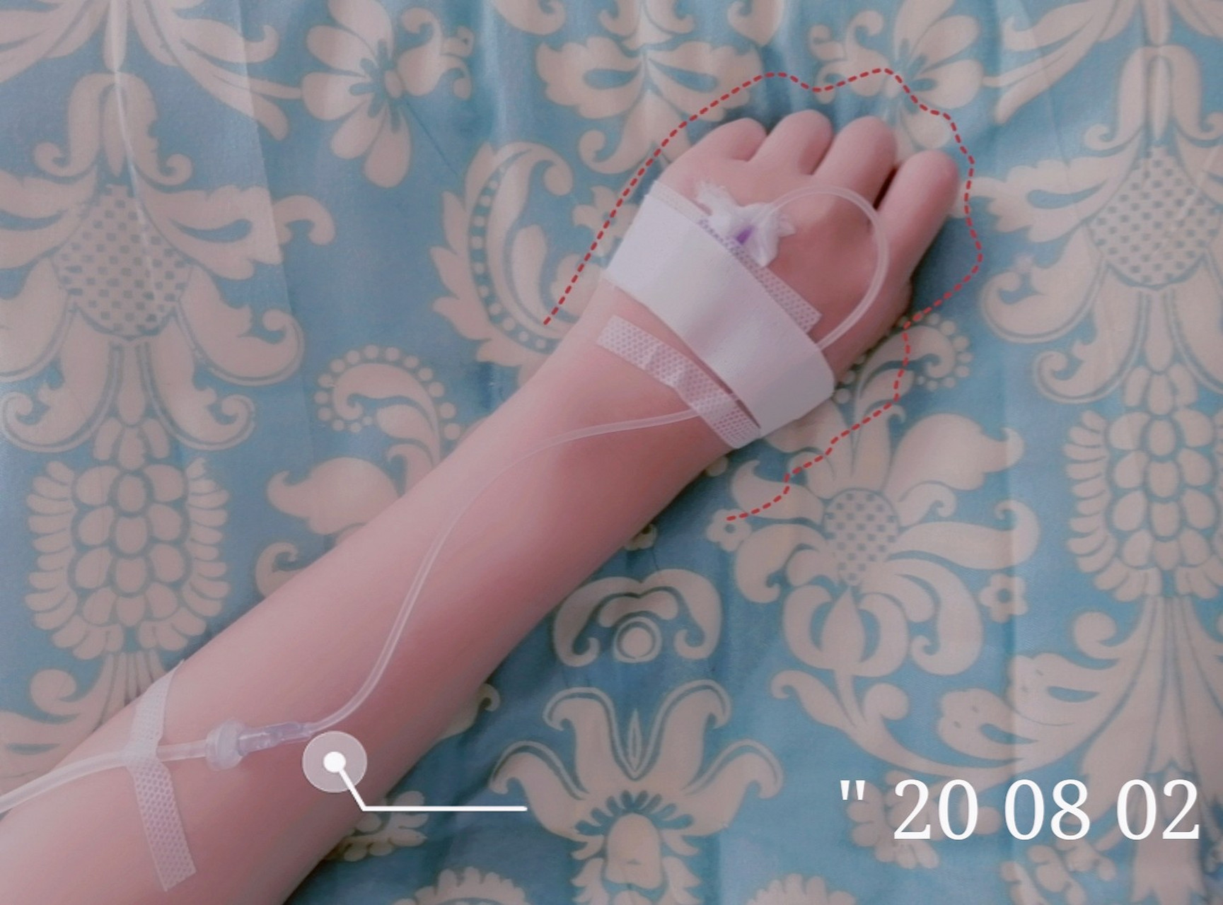 教你输液时这样发朋友圈 94666666946666669466