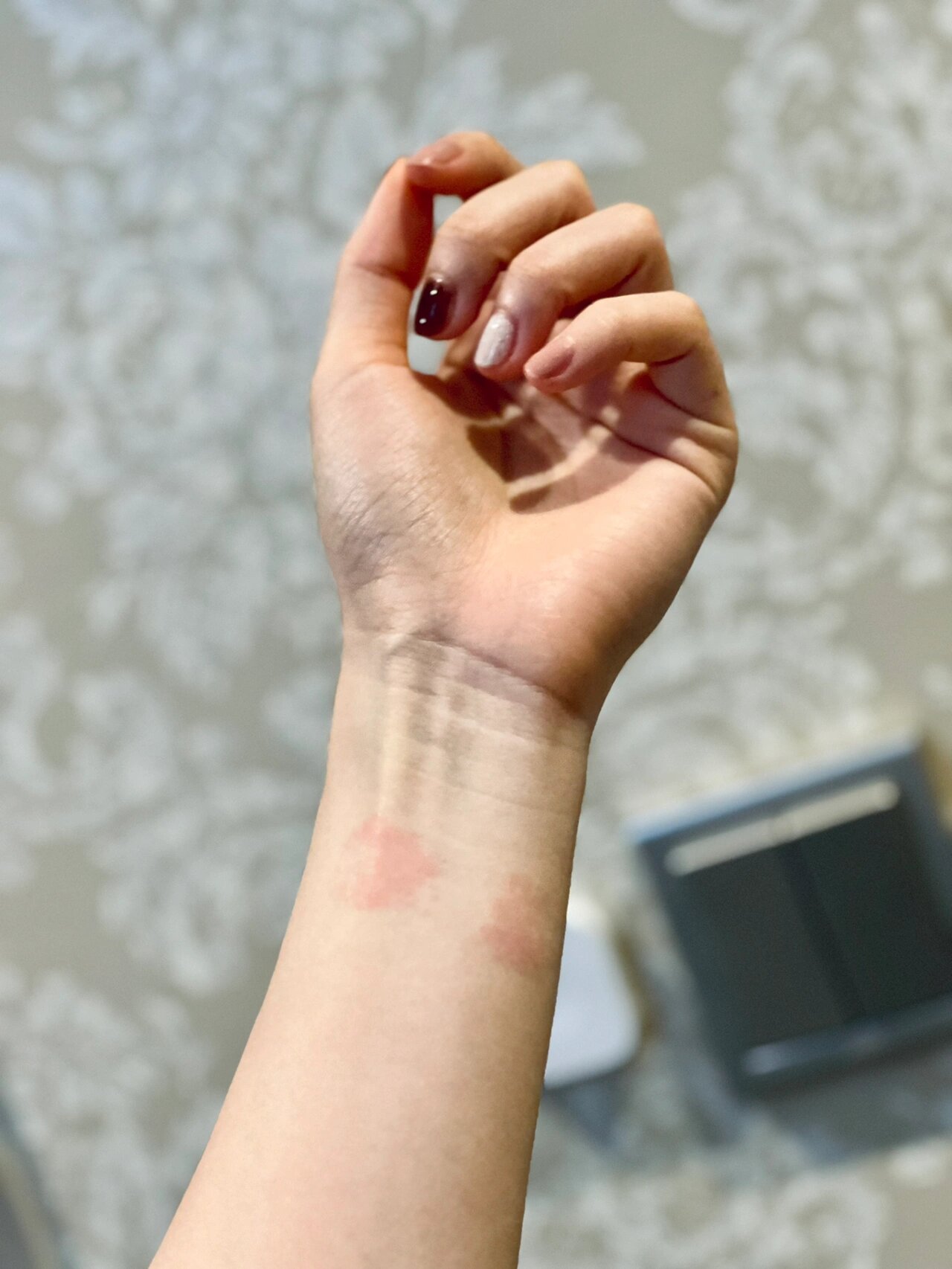 apple watch硅胶表带过敏