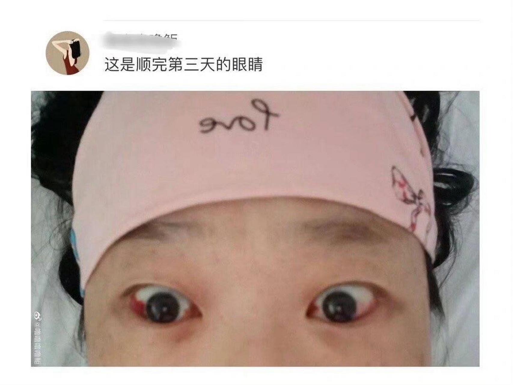 眼球高于眉骨太难看了图片