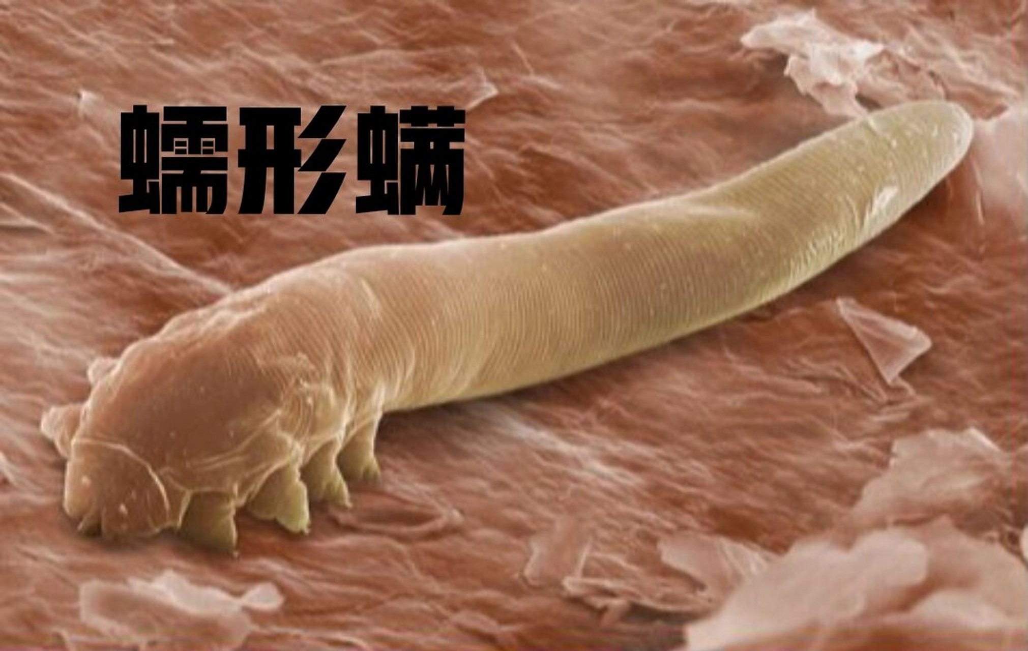 图一:蠕形螨91,又称毛囊虫,毛囊螨,寄生于多种哺乳动物,包括人的