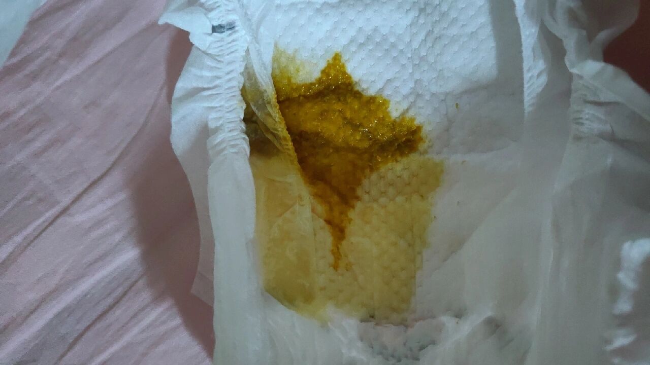宝宝腹泻拉黄水怎么办