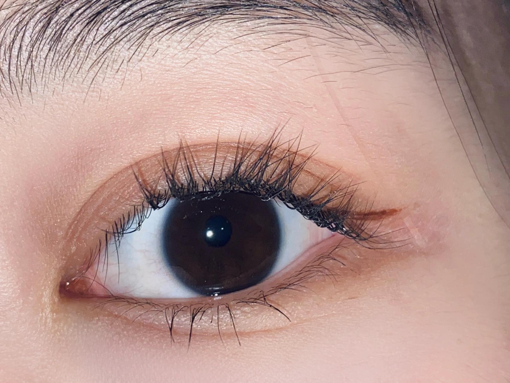 偶然刷到关于眼下这一条纹 叫阴骘纹 偶然刷到关于眼下这一条纹 叫