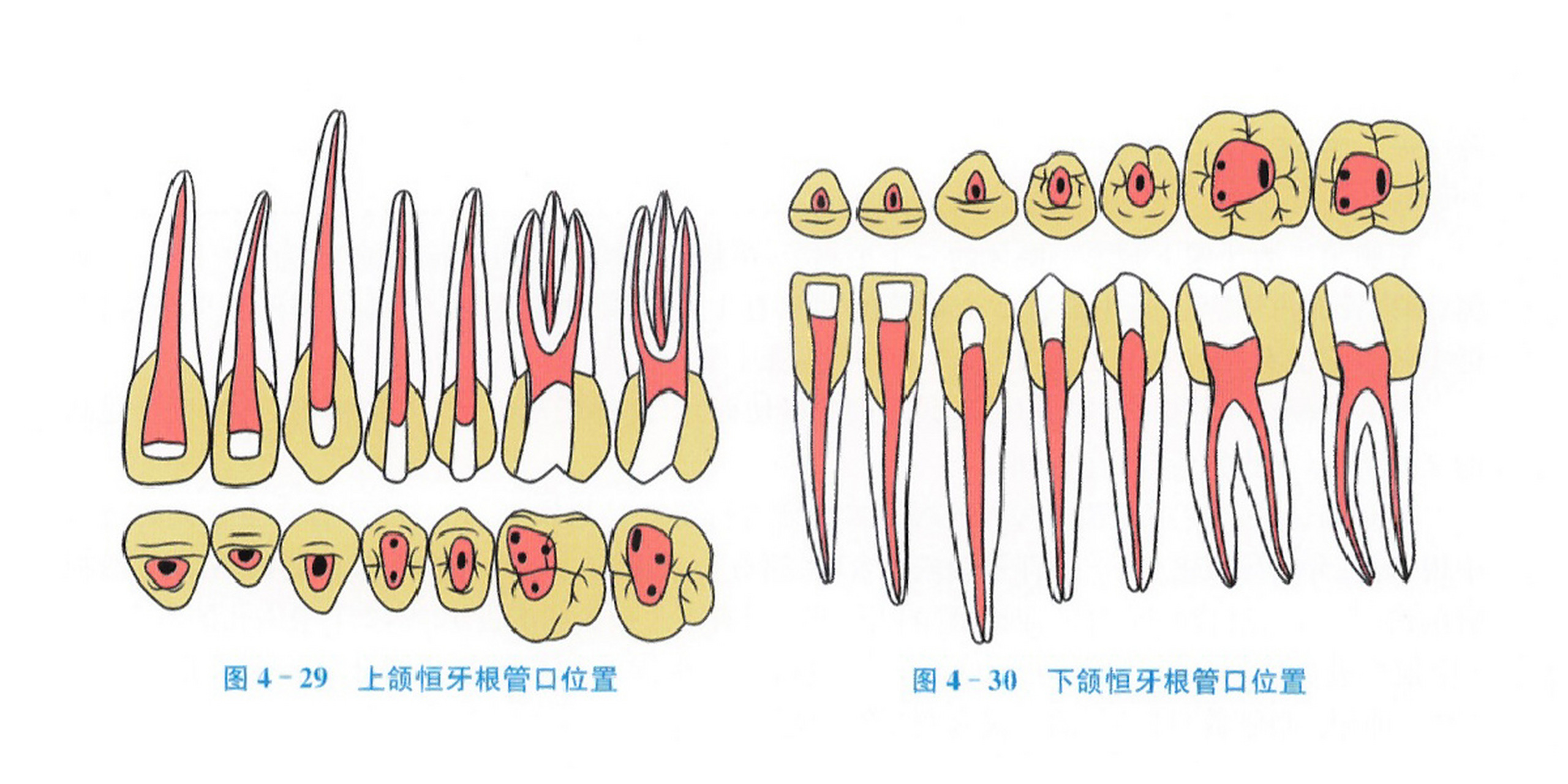 根管口的位置图谱