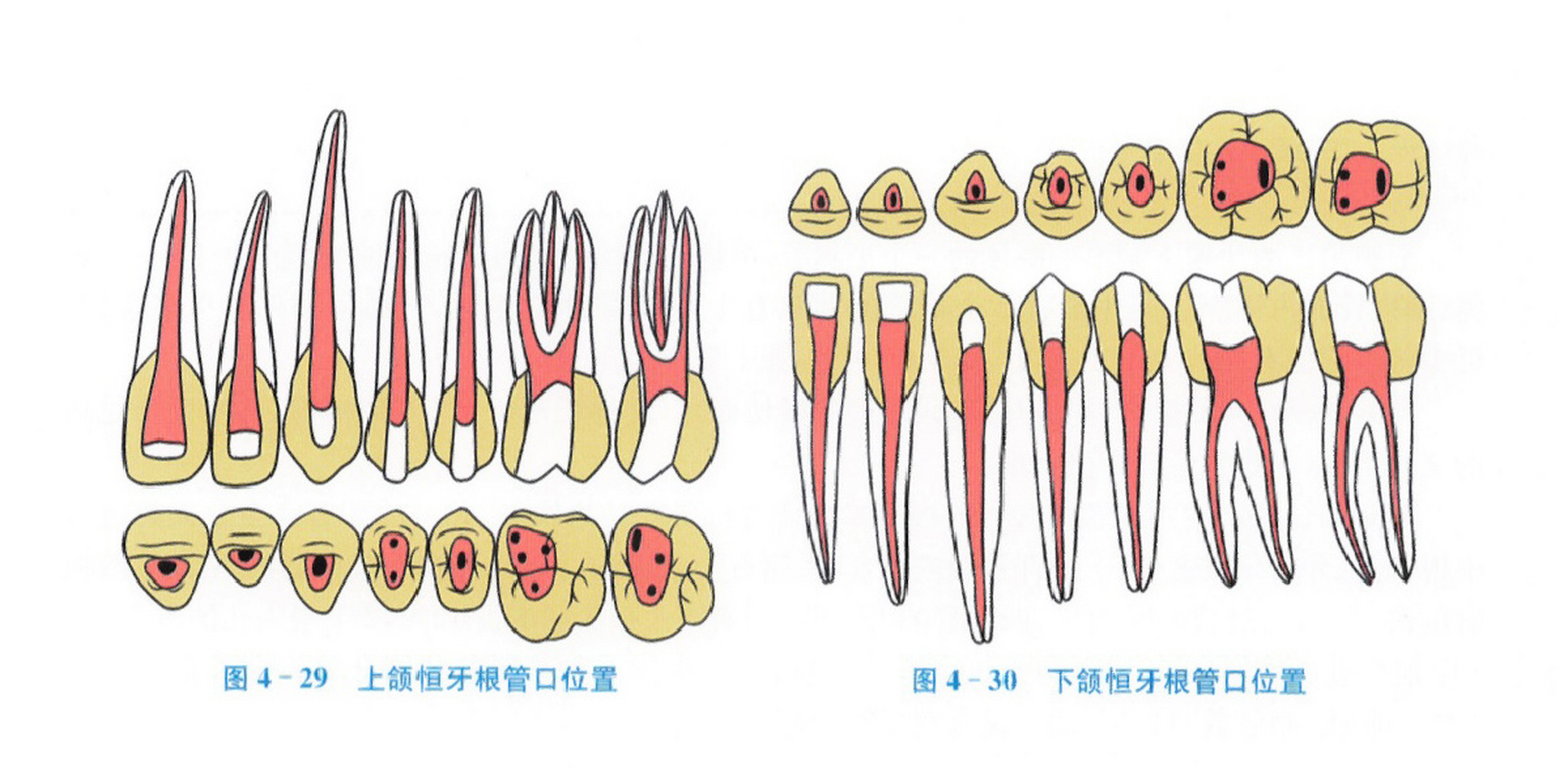 乳牙根管形态图片