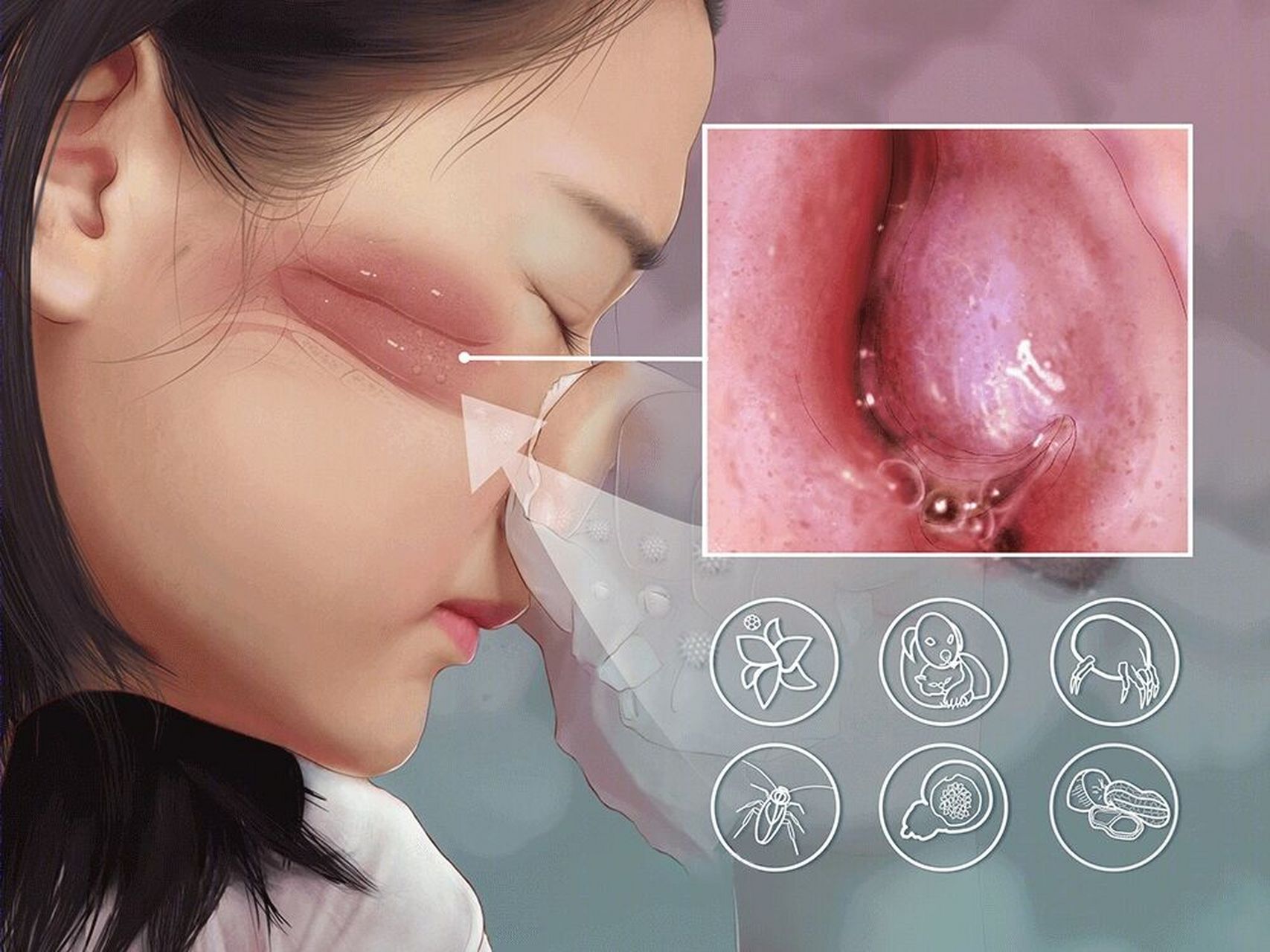 鼻塞,头为什么秋天过敏性鼻炎易发作? 过敏性鼻炎