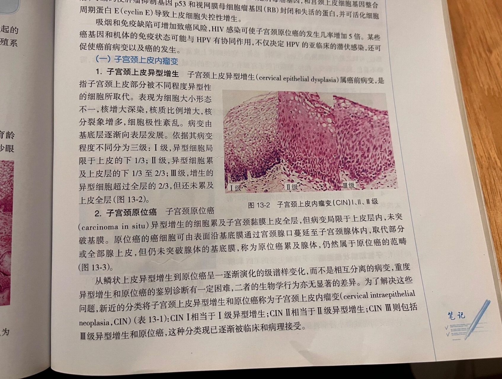 书本知识科普——宫颈原位癌 这个是我在我弟弟的医学课本上看到的