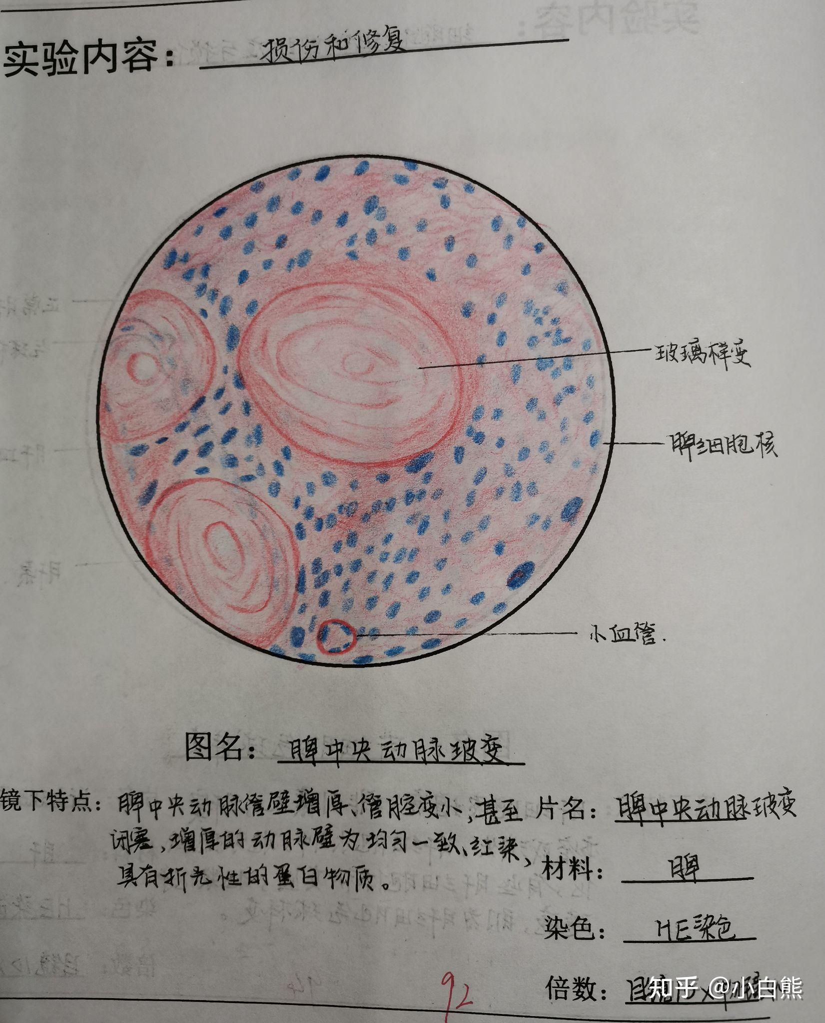 病理绘图红蓝铅笔图片