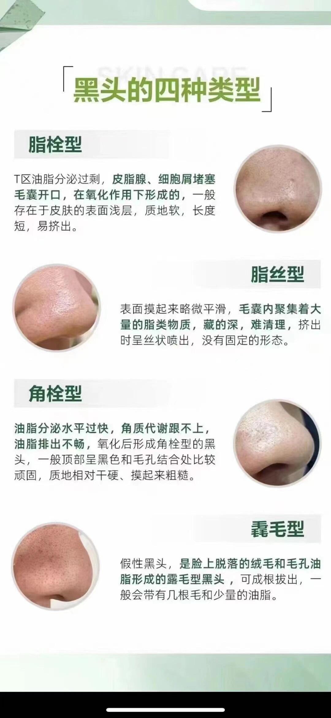 黑头的四种类型～ 99脂栓型:长度短09易挤出 99脂丝型:藏的深