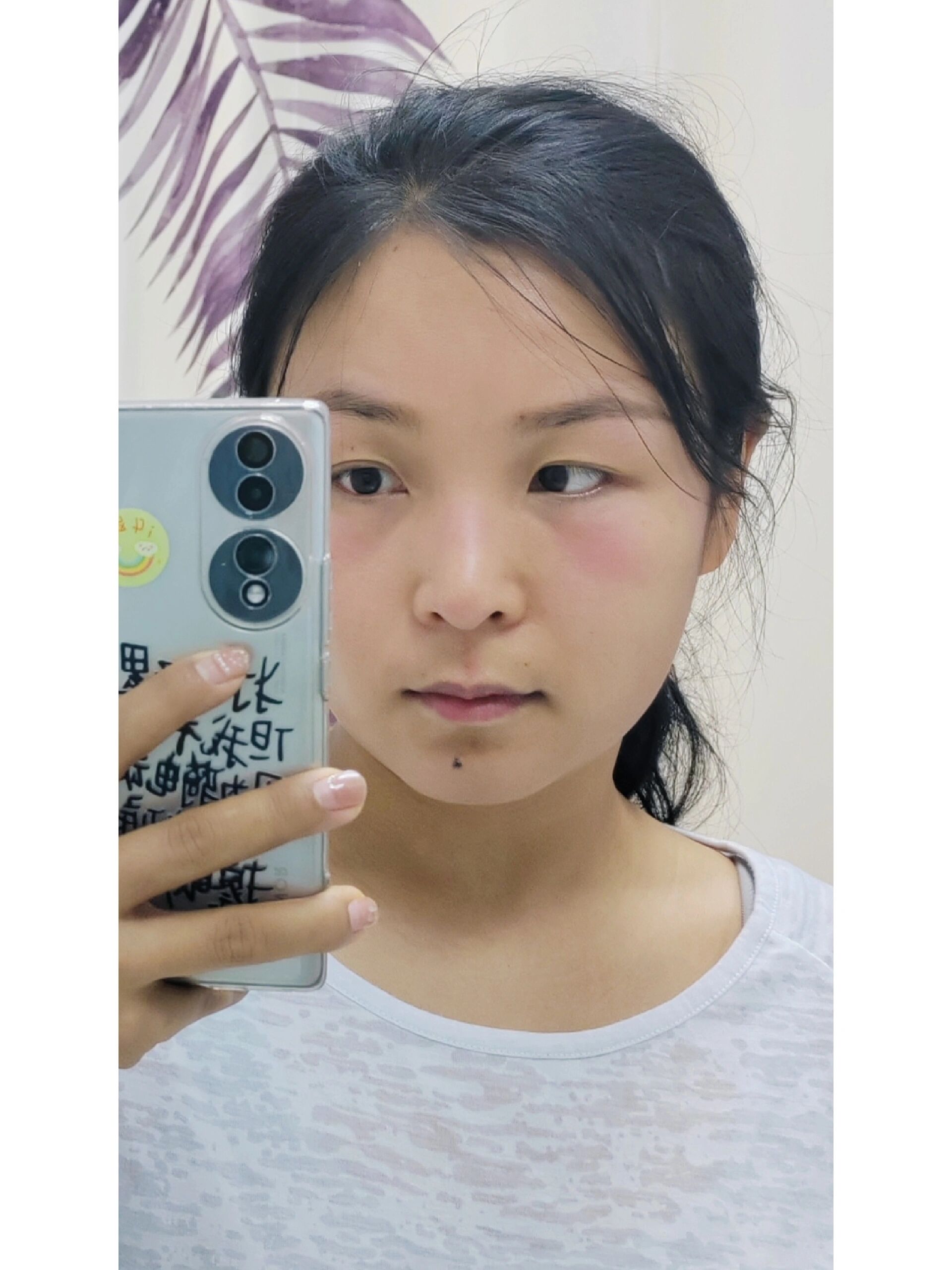 单纯疱疹好烦啊啊啊 中午健完身自拍发现人中红红的 到了晚上就一下子