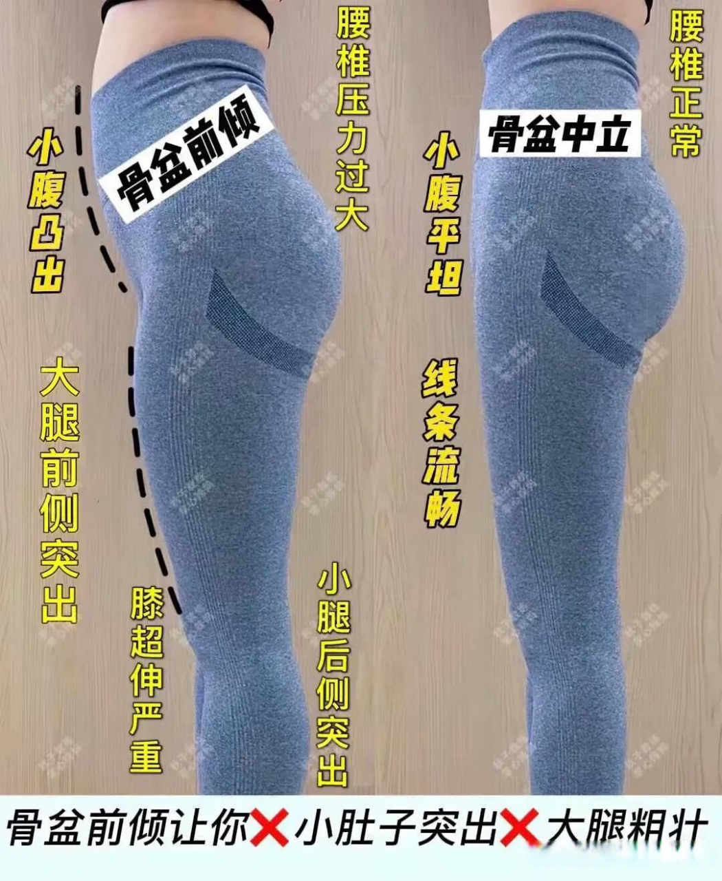 我一并列出来骨盆前倾的危害72 1,腰曲过大,产生腰痛,肩背疼 2,肚子