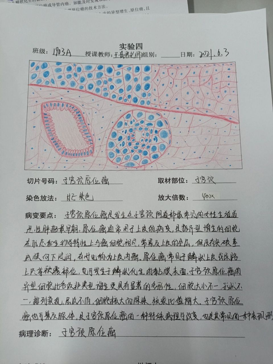 癌巢手绘图图片