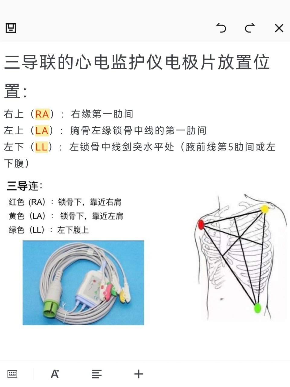 监护五导联位置图片图片