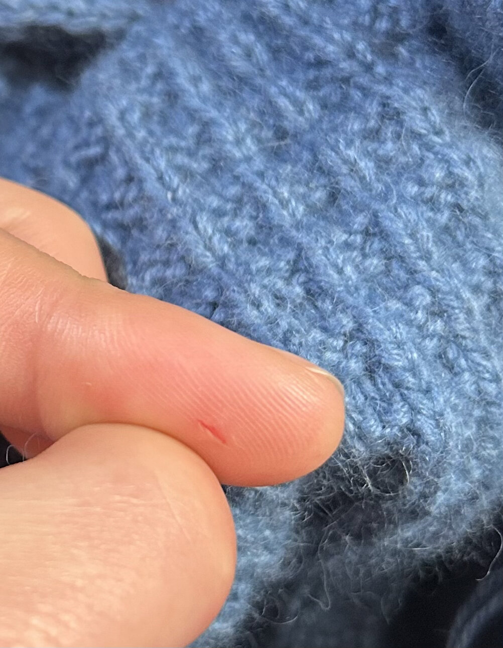 太离谱了7575我手指被棒针戳破了 居然被棒针戳进去,这么钝的针诶