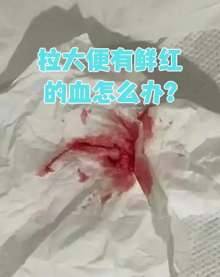 男生为什么会拉血为什么在线 男生为什么会拉血为什么在线