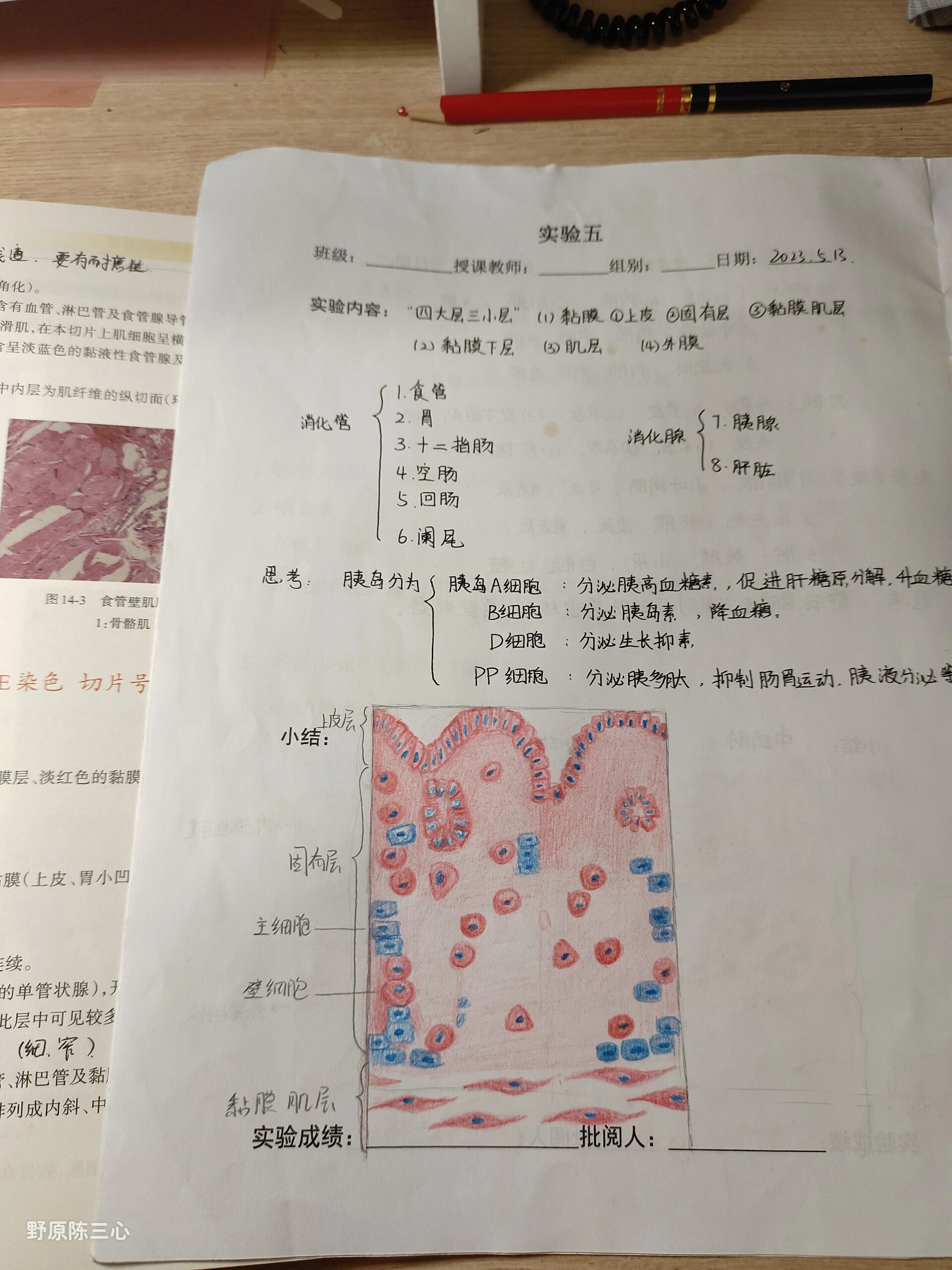 整个胃点胃溃疡手绘图图片