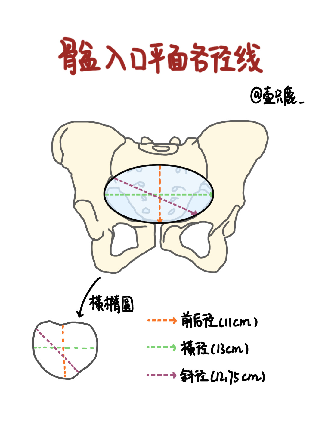 95骨盆入口平面 为骨缘盆腔上口,呈横椭圆形.前后径(真结合径)