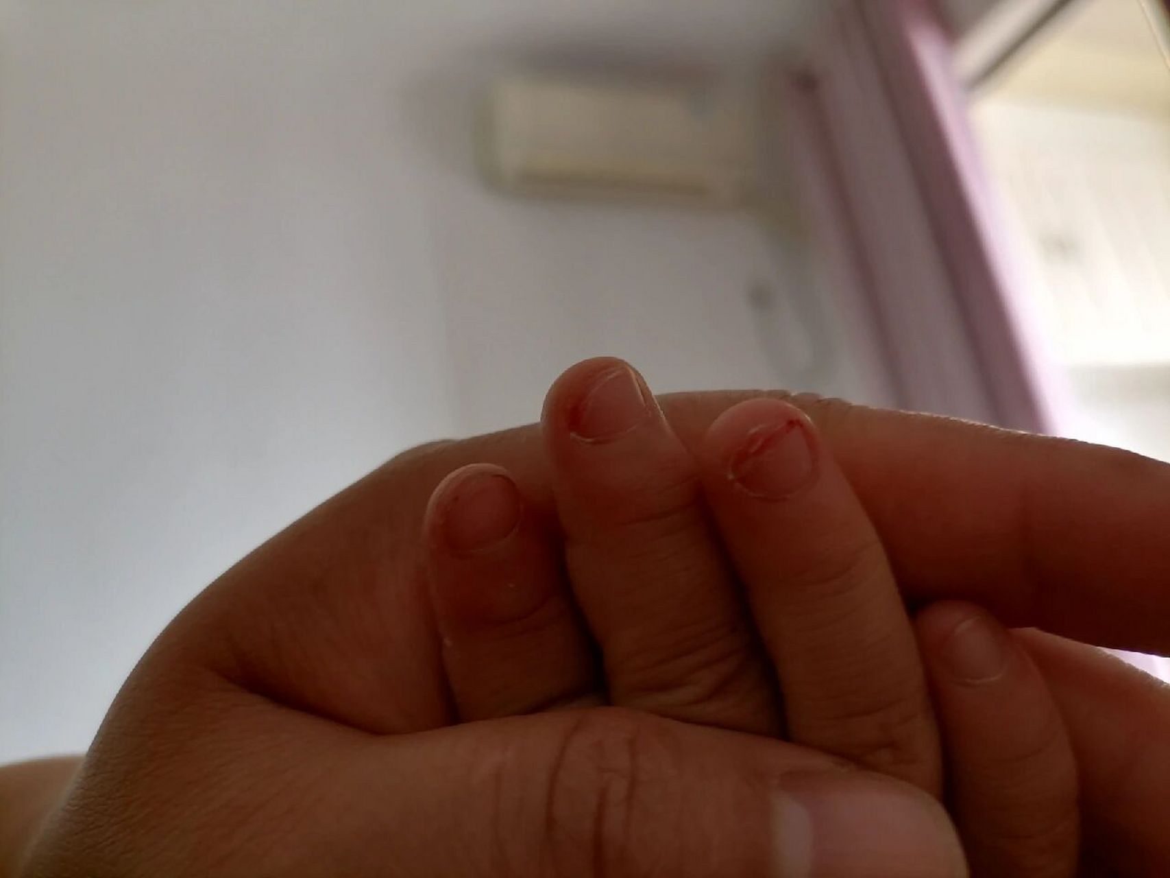 3岁孩子喜欢抠指甲怎么回事 我女儿3岁了,最近刚刚出现爱抠指甲的症状