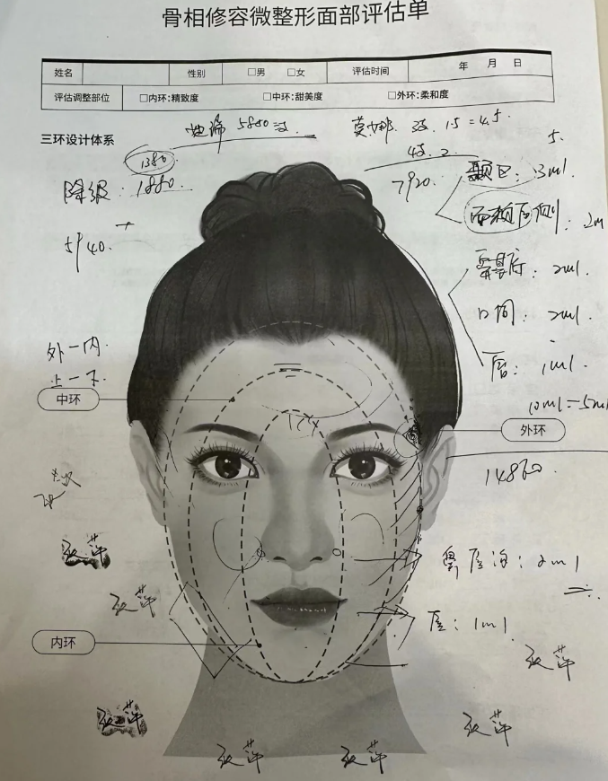 或是完美的立体骨相,都是高级骨 面部 45° 测脸分析画线面部骨线示意