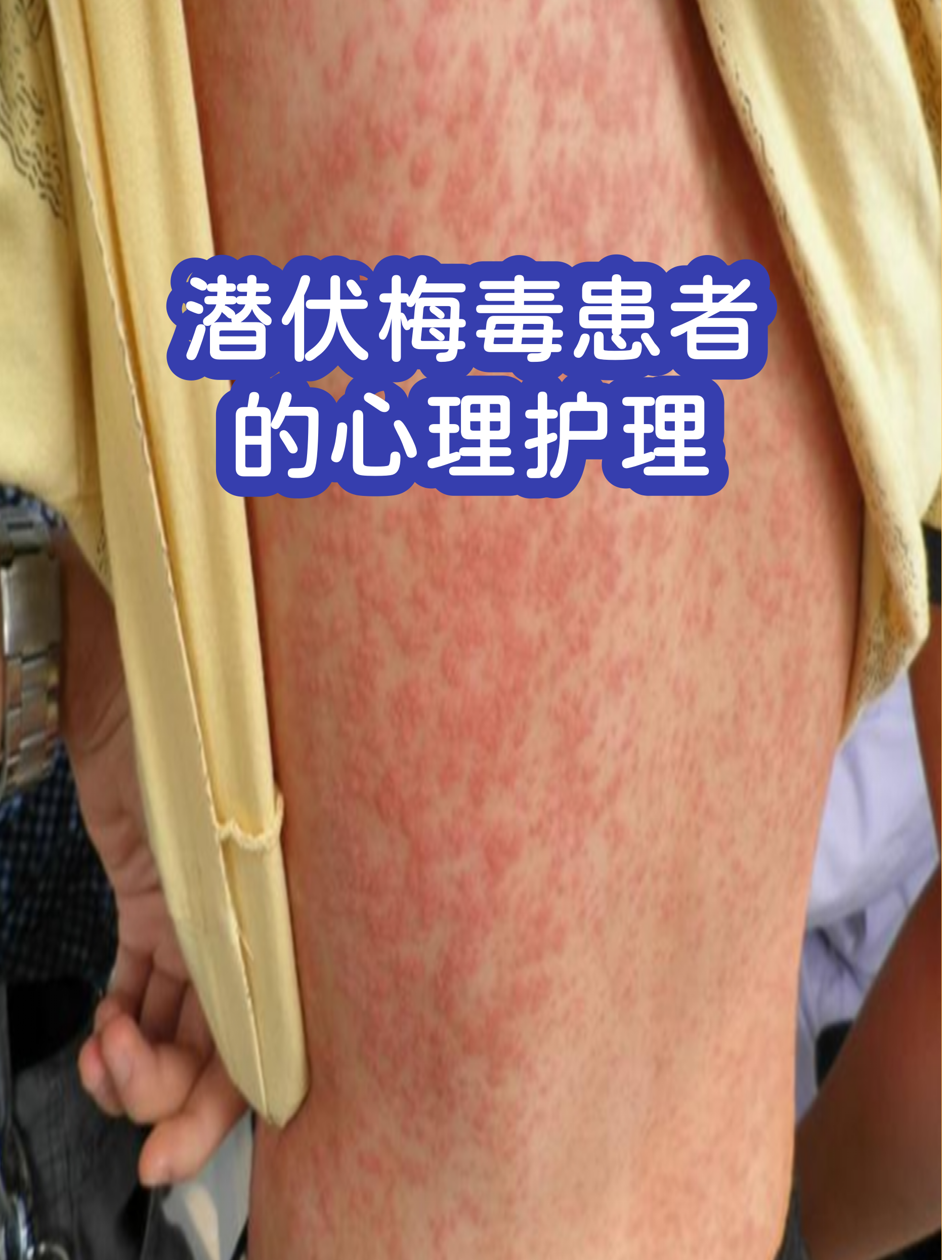 北京大学第六医院陪诊协助挂号复杂病情综合分析，治疗方向更明确的简单介绍