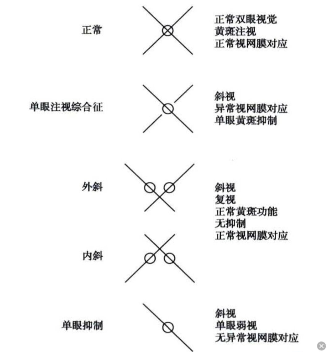 怎样通过线状镜判断双眼有无抑制,复视?