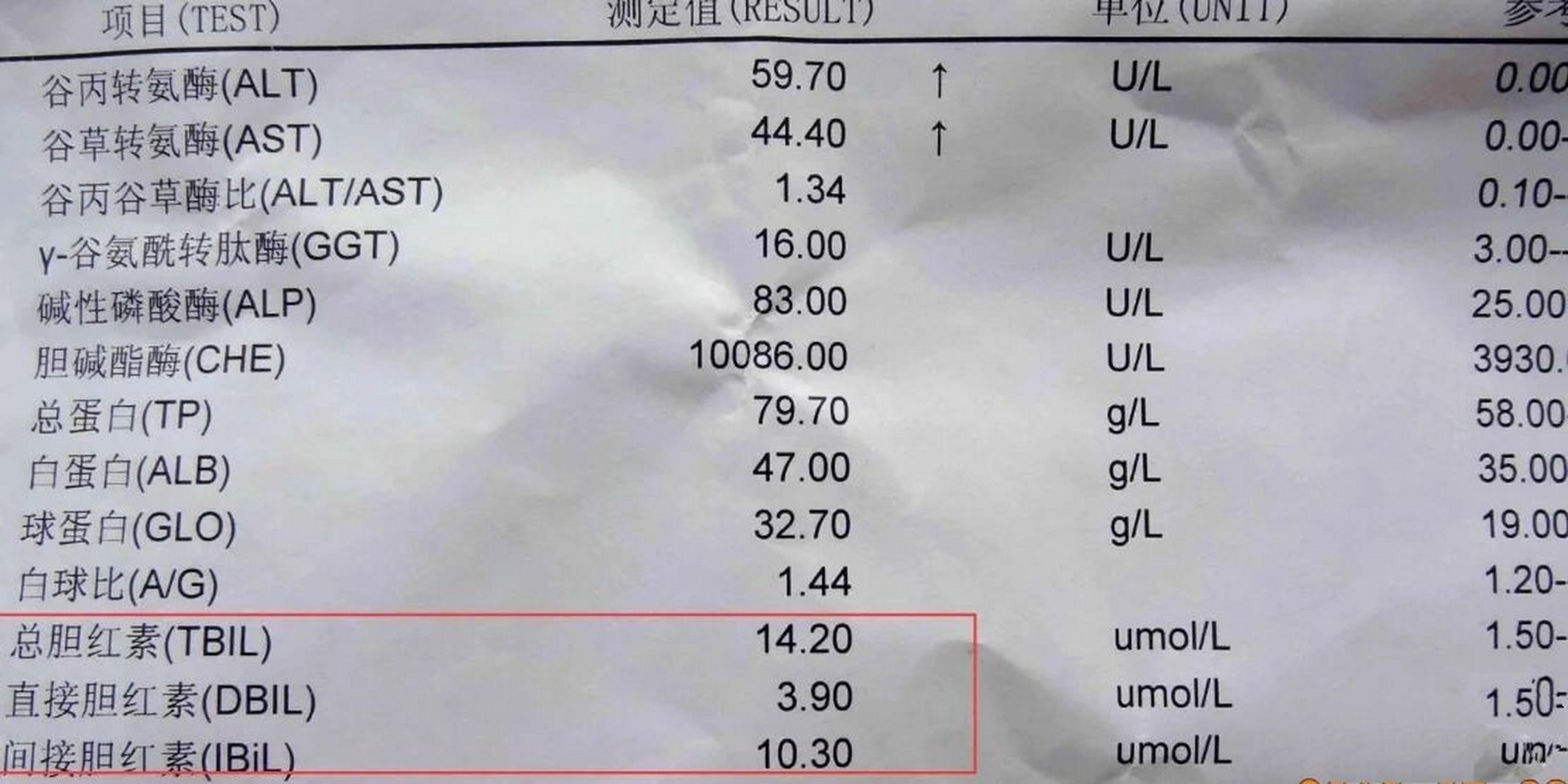 总胆红素升高 在肝功能化验单中有一个重要的指标,那就是胆红素.