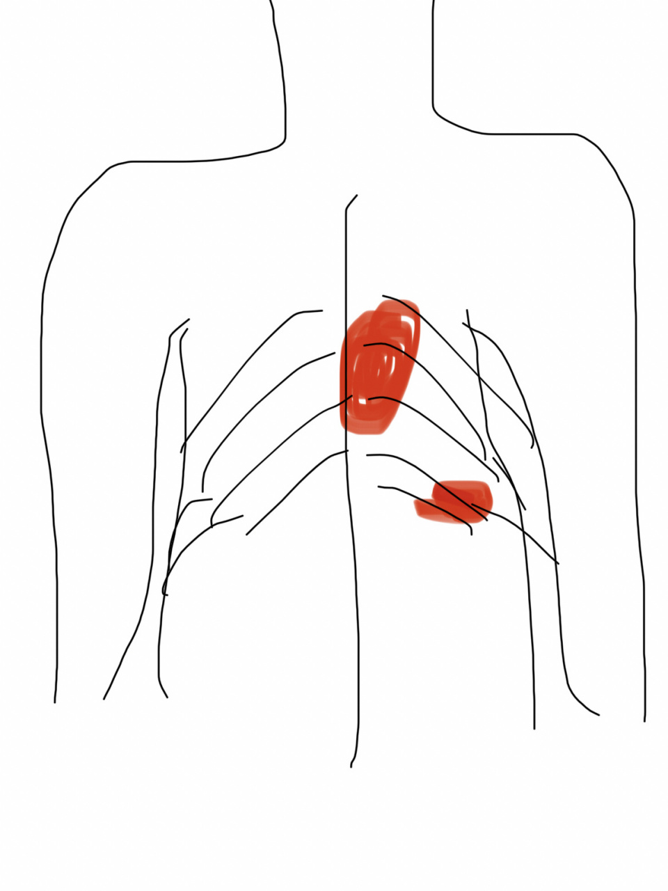 有没有左胸口和肋骨连接到后背痛的朋友们呀,今天早上突然间痛,吓得我