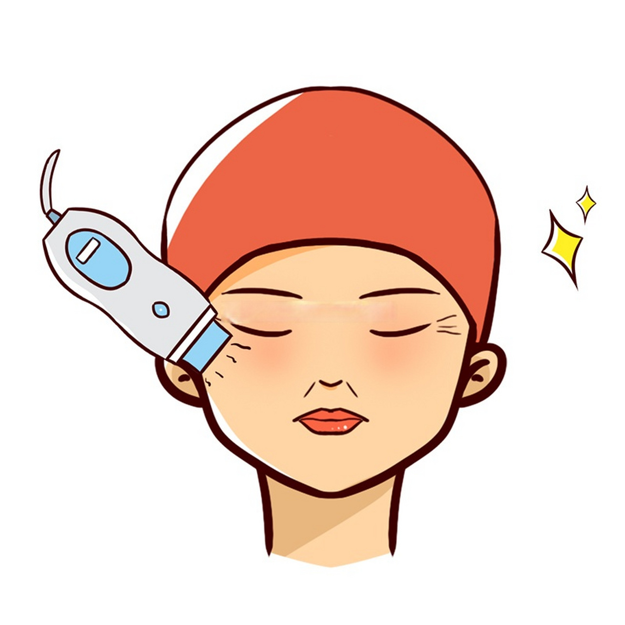 【近视手术和眼周热玛吉治疗的先后顺序及间隔时间】