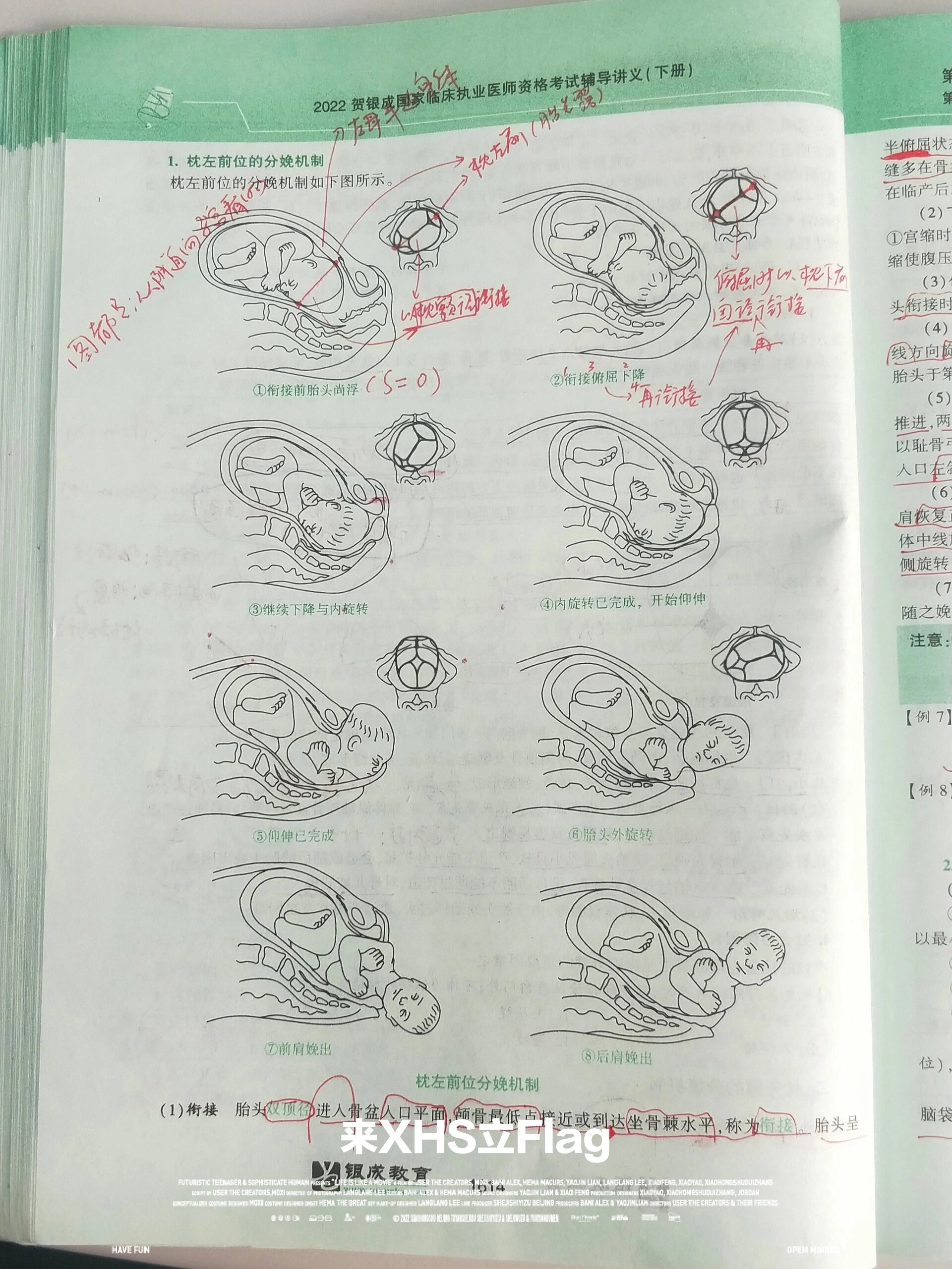 分娩机制 图解