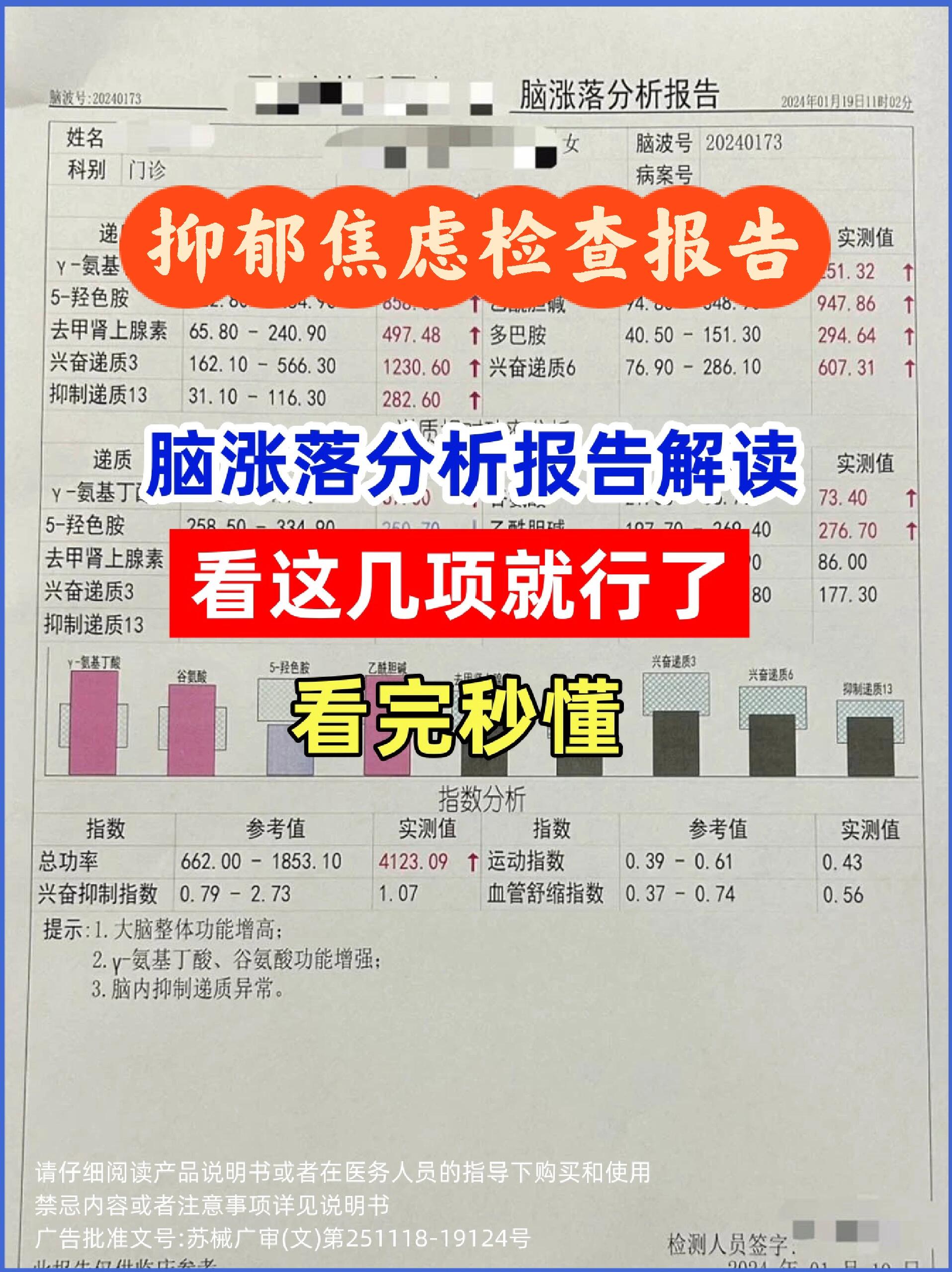 73轻松get脑涨落分析报告单!