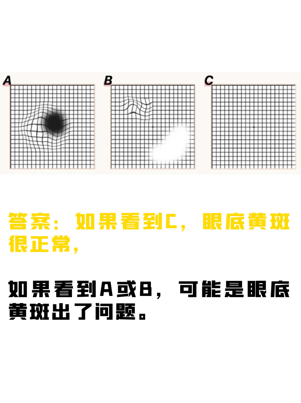 需配戴原有的眼镜进行测试; 用手盖着一只眼,测试眼凝视方格表的中心
