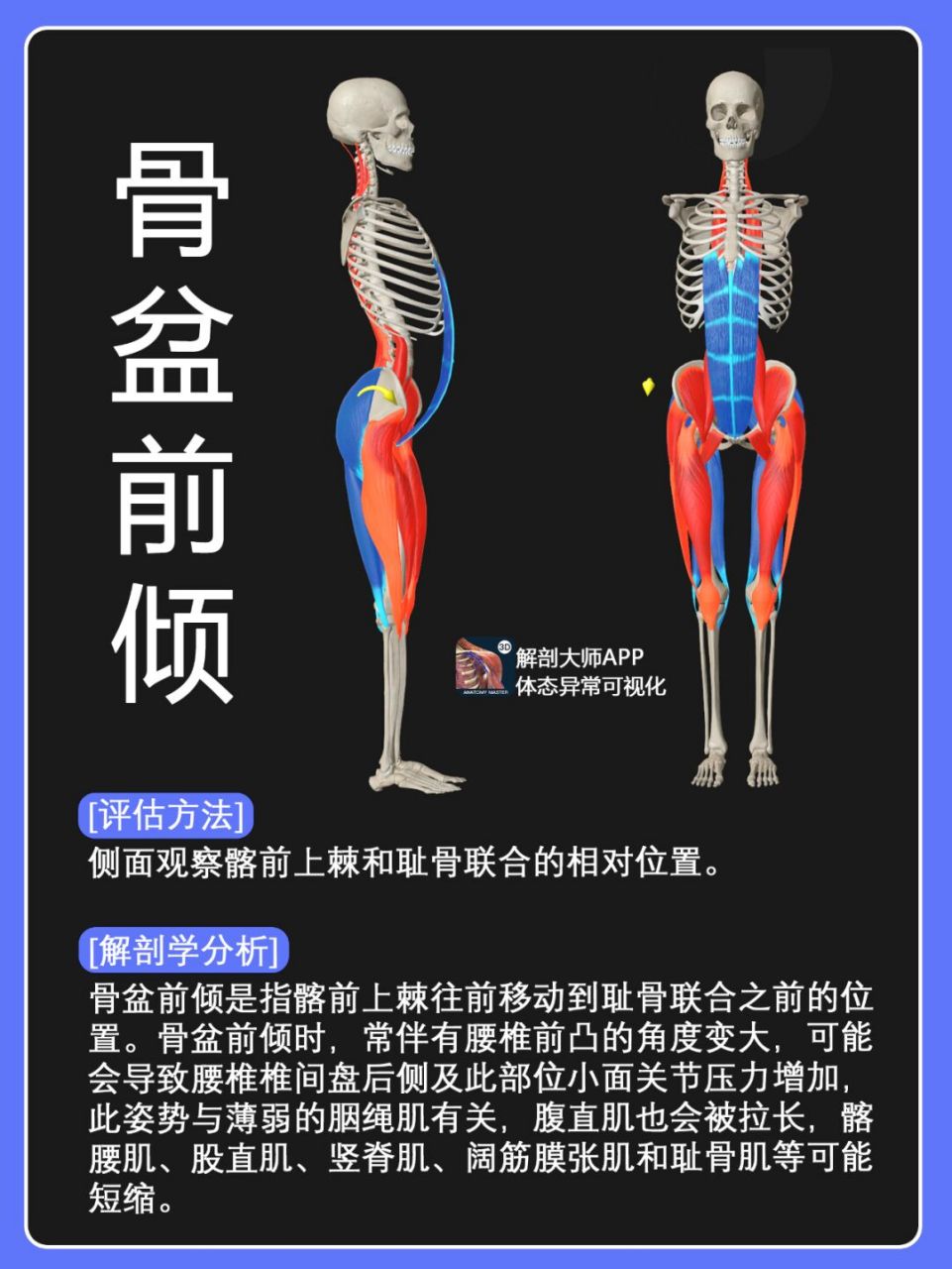从解剖学的角度再次认识骨盆前倾 侧面观察髂前上棘和耻骨联合的相对