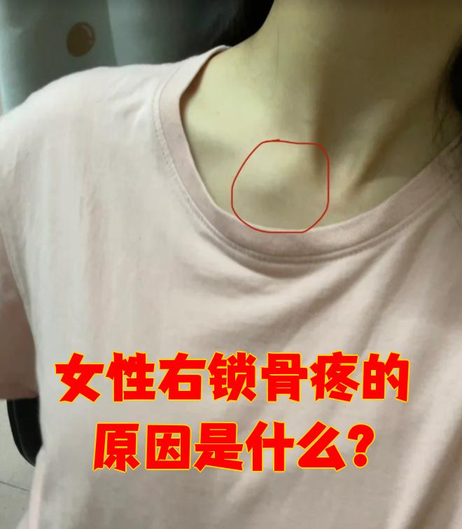 女性右锁骨疼常见原因有以下几种: