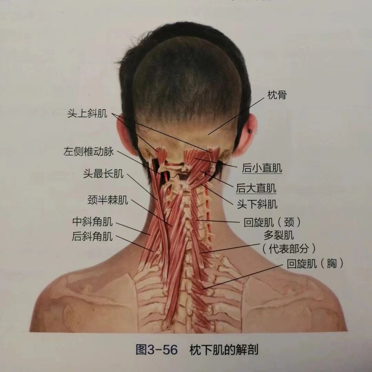 头痛为什么与颈部有关 头部的神经大都来自颈部