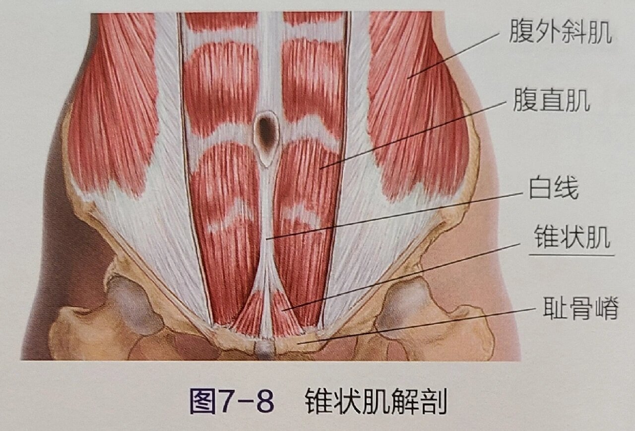 锥状肌的松解 7815锥状肌常见于一侧