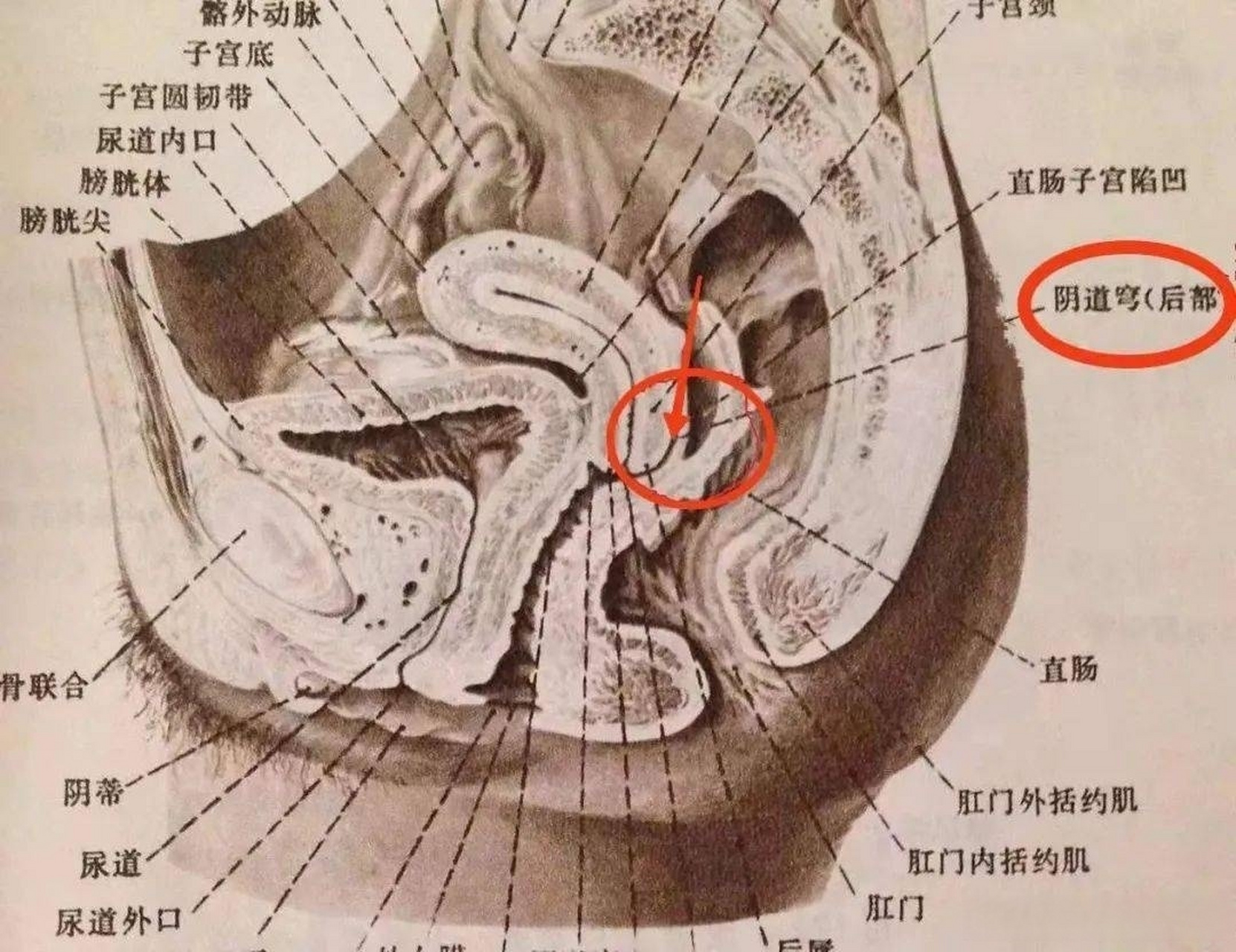 后穹窿部是什么部位图片