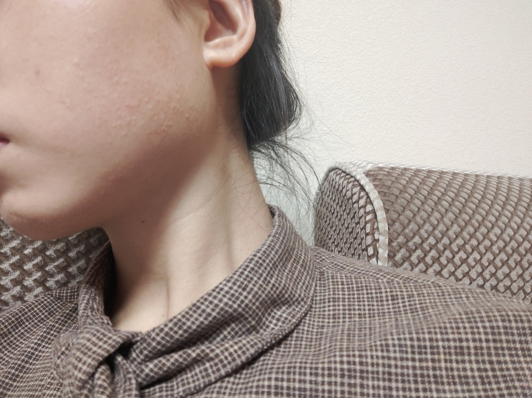 脸颊两边长的小疙瘩,到底是什么啊,每到夏天就很多