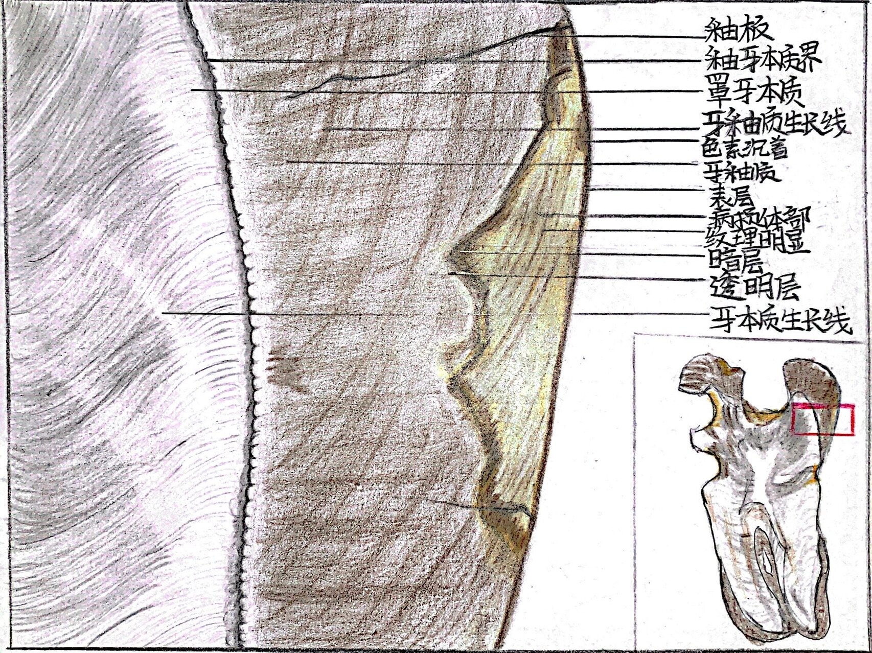 口组病绘图·牙釉质平滑面龋(进来讨论问题) 这次画的不算好,p2老师