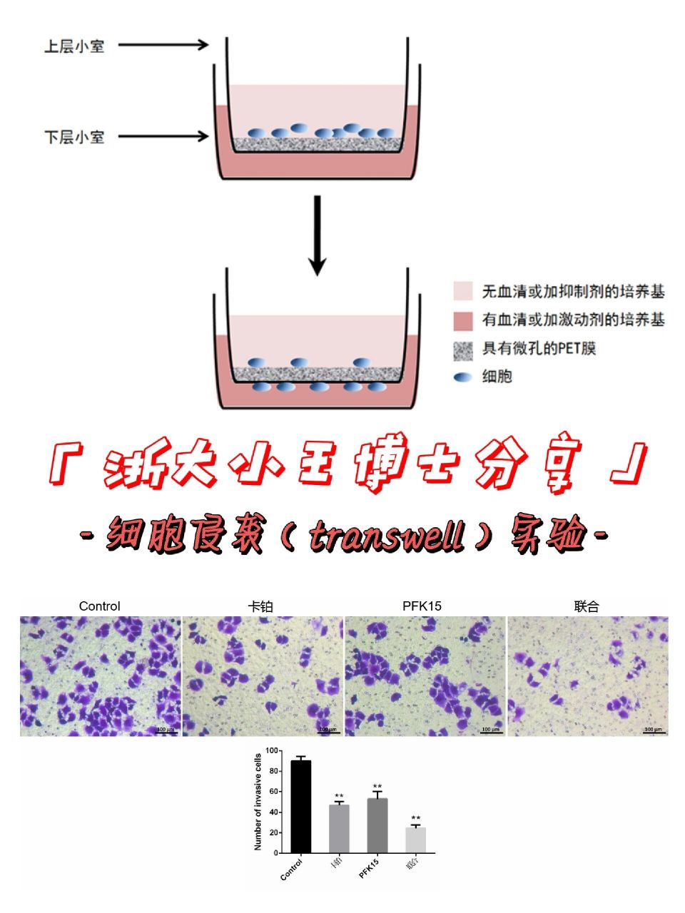 浙大小王博士分享细胞侵袭transwell实验  体外transwells小室趋化