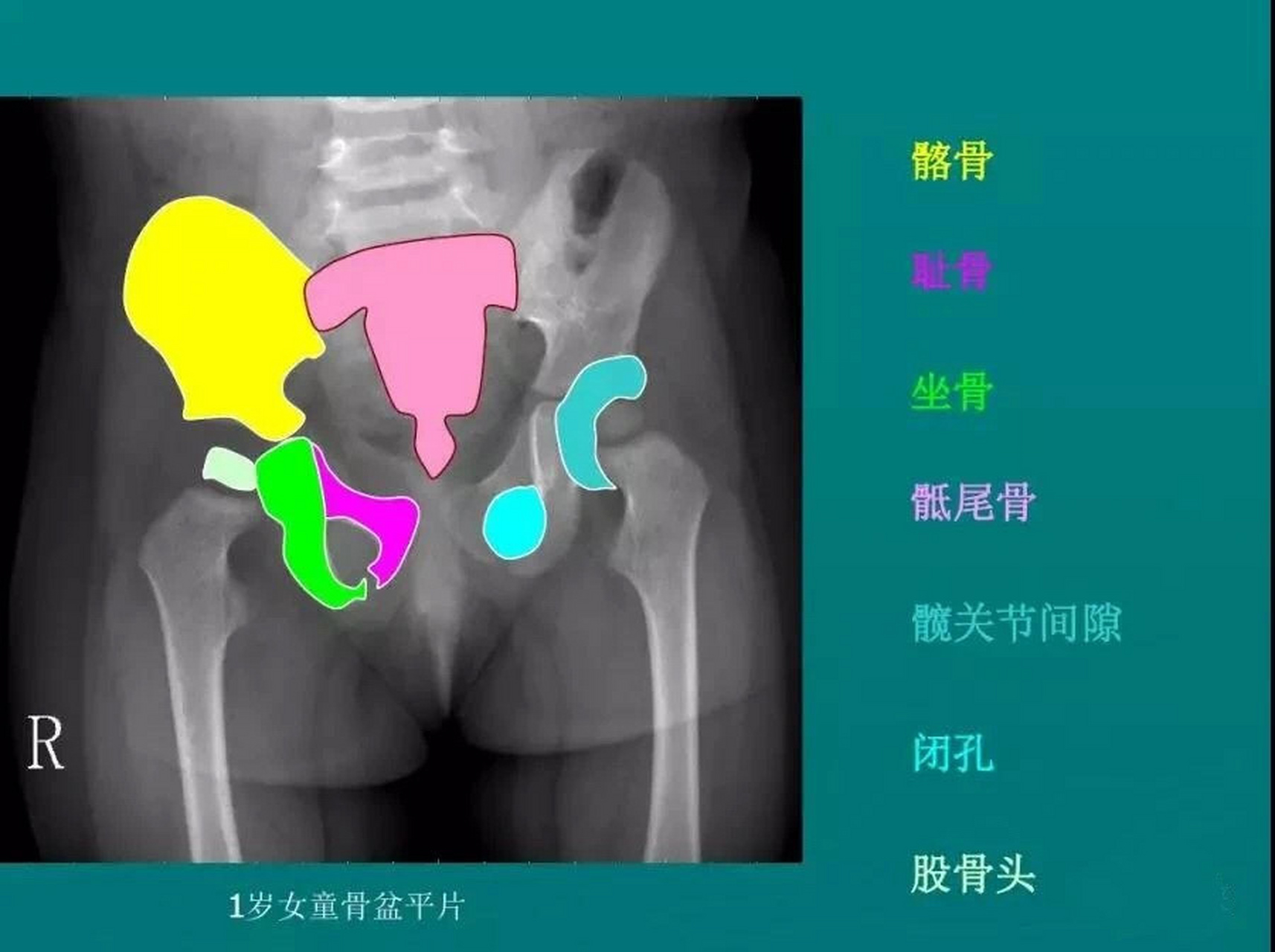 髋关节影像解剖高清图